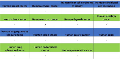 Wilms Tumor Protein (WT1) Recombinant Rabbit mAb (SDT-2864)