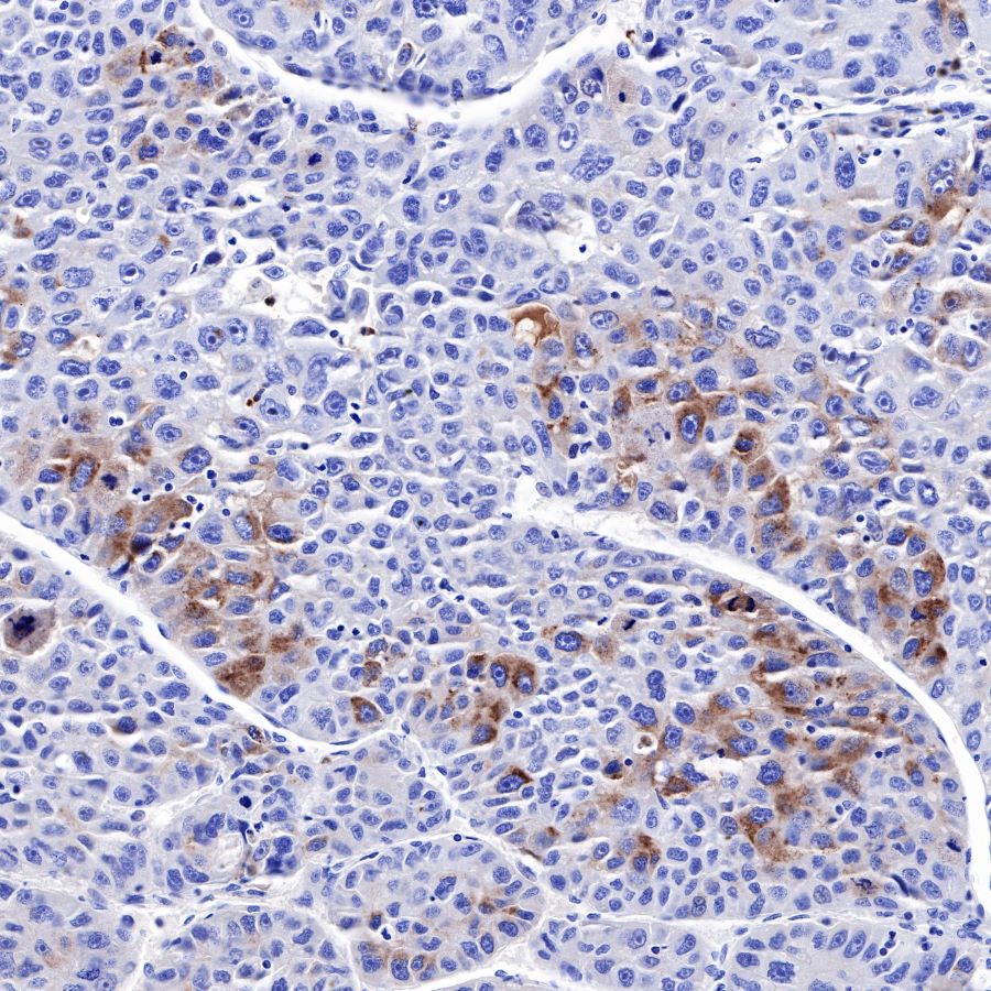 AFP Recombinant Rabbit mAb (SDT-R031)