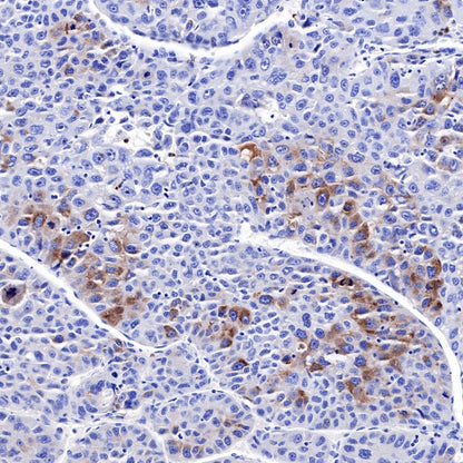 AFP Recombinant Rabbit mAb (SDT-R031)