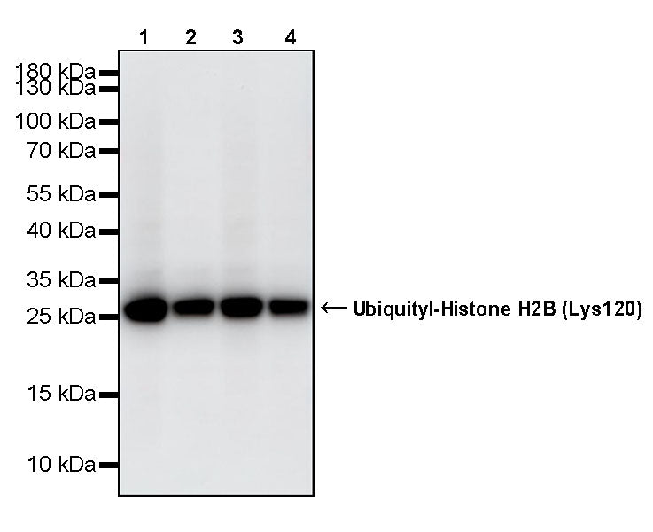 Ubiquityl-Histone H2B (Lys120) Recombinant Rabbit mAb (S-5698)