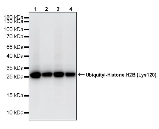 Ubiquityl-Histone H2B (Lys120) Recombinant Rabbit mAb (S-5698)