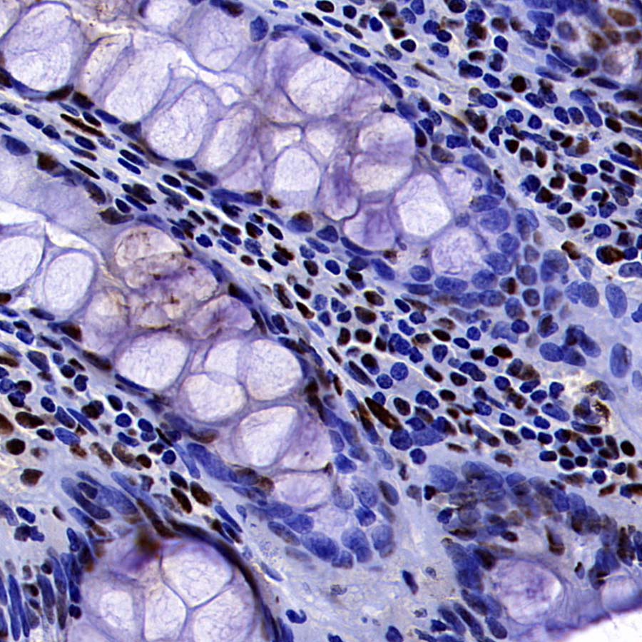 DDX39B Recombinant Rabbit mAb (S-4549-30)