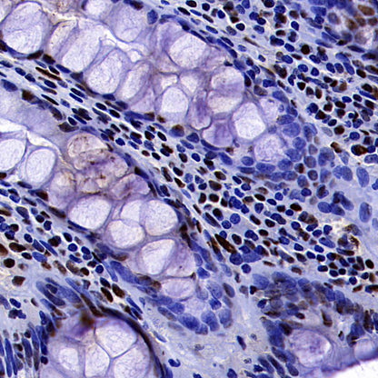 DDX39B Recombinant Rabbit mAb (S-4549-30)