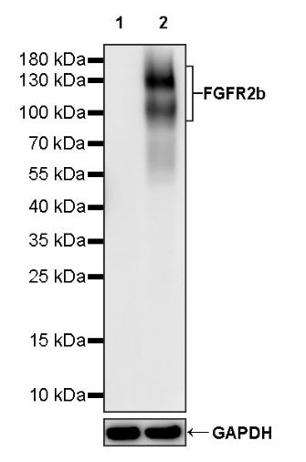 FGFR2b Recombinant Rabbit mAb (SDT-423-121)