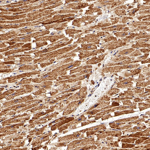 ATPB Rabbit Polyclonal Antibody