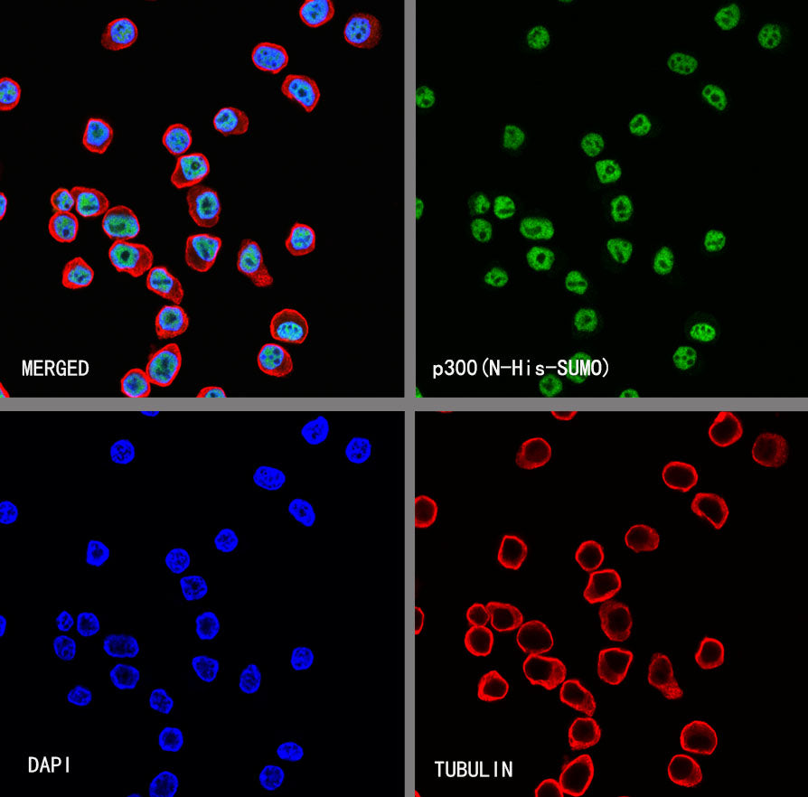 p300 Recombinant Rabbit mAb (S-2612-122)