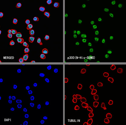 p300 Recombinant Rabbit mAb (S-2612-122)