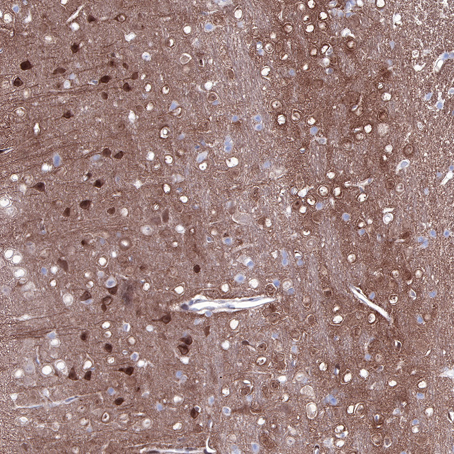 PTEN Recombinant Rabbit mAb (SDT-R074)