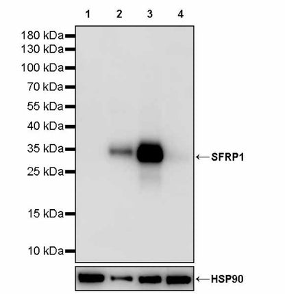 SFRP1 Recombinant Rabbit mAb (S-3071-18)