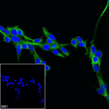 Beta III Tubulin Recombinant Rabbit mAb (S-5529)