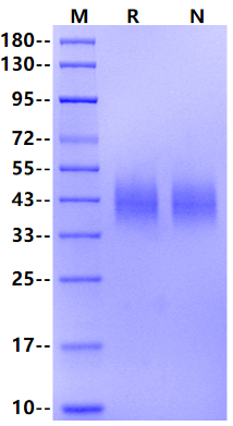 B7-2/CD86 His Tag Protein, Mouse