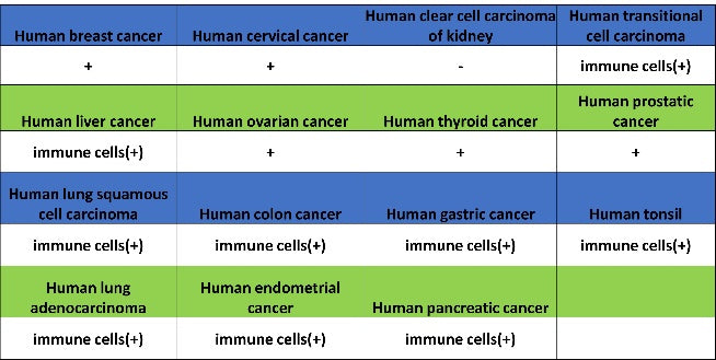 PKC delta Recombinant Rabbit mAb (S-2611-39)