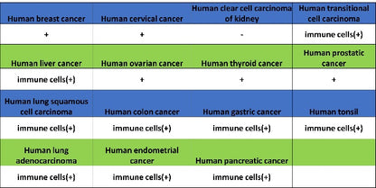 PKC delta Recombinant Rabbit mAb (S-2611-39)