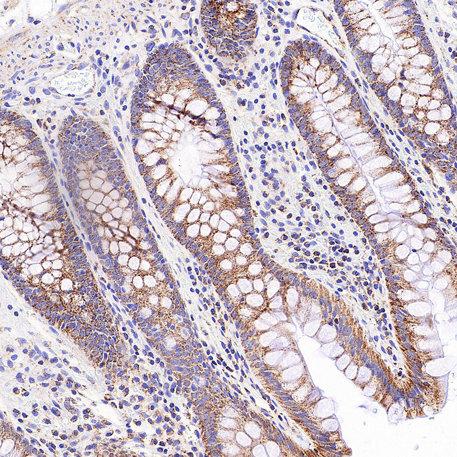 TFAM Recombinant Rabbit mAb