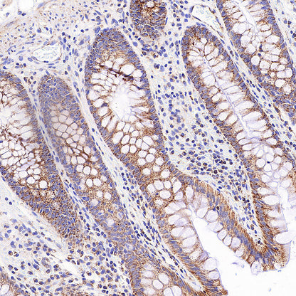 TFAM Recombinant Rabbit mAb
