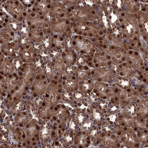 FTO Recombinant Rabbit mAb (S-1663-48)