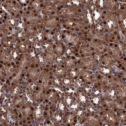 FTO Recombinant Rabbit mAb (S-1663-48)
