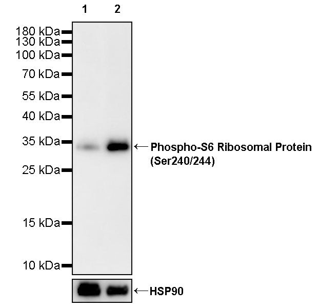 Phospho-S6 Ribosomal Protein (Ser240/244) Recombinant Rabbit mAb (S-4983)