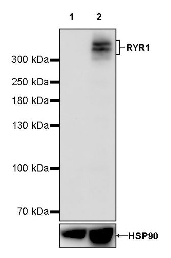 RYR1 Recombinant Rabbit mAb (S-2026-22)