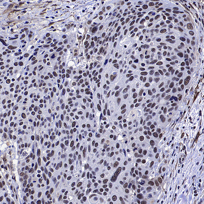Caspase-8 Recombinant Rabbit mAb (S-2676-121)