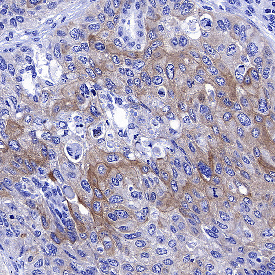 Gli2 Recombinant Mouse mAb (S-5691)
