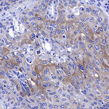 Gli2 Recombinant Mouse mAb (S-5691)