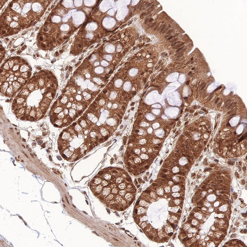 RBX1 Recombinant Rabbit mAb (S-R355)