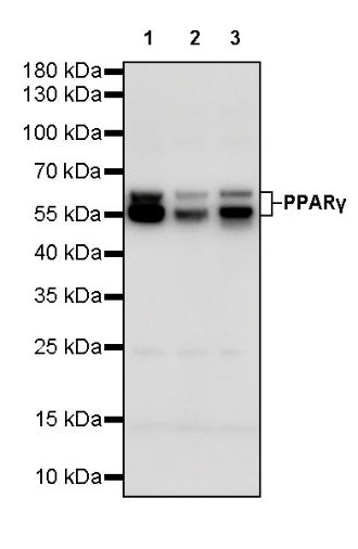 PPARγ Recombinant Rabbit mAb (SDT-556-108)