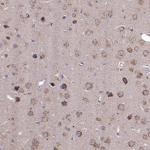 Man6P Recombinant Rabbit mAb (S-2745)