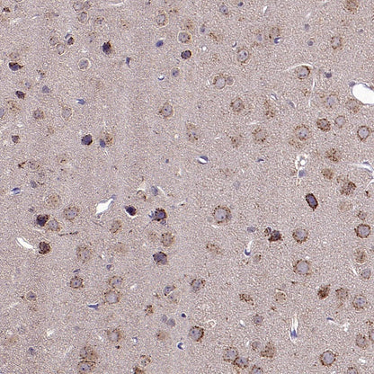 Man6P Recombinant Rabbit mAb (S-2745)