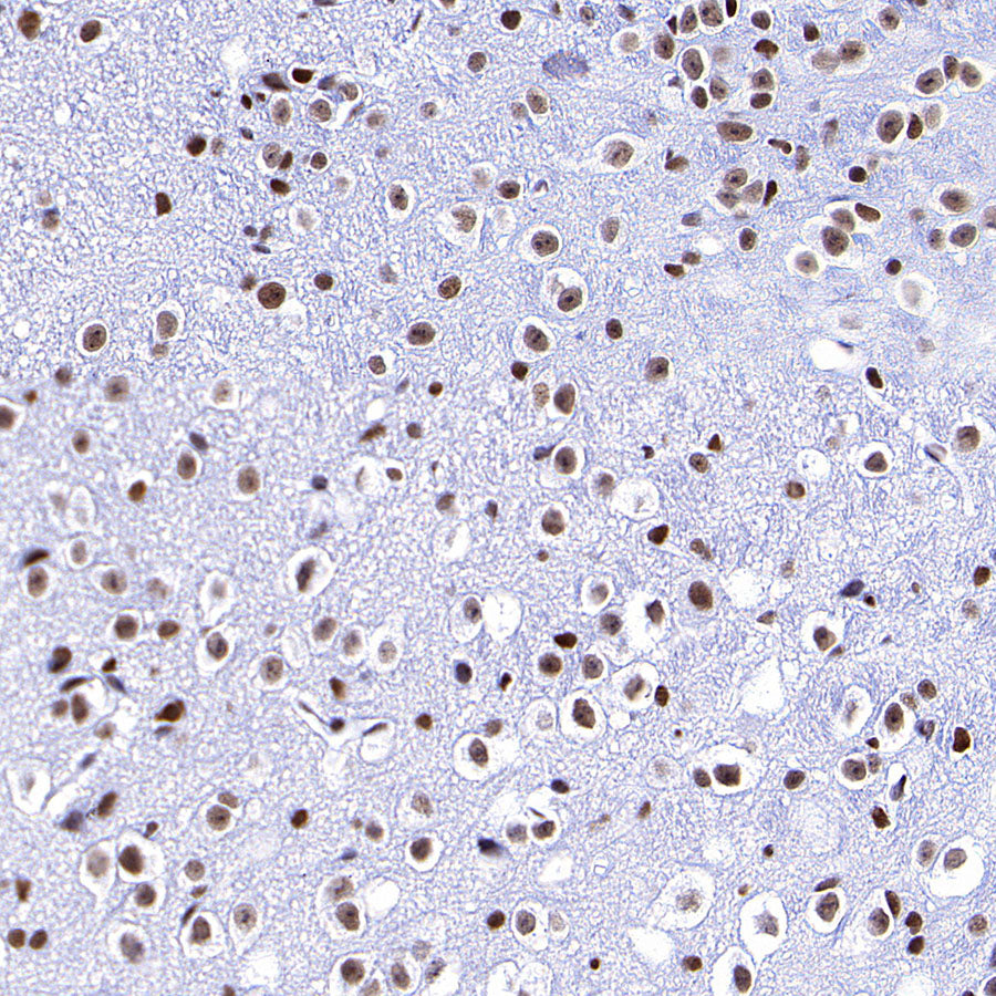 RBBP4 Rabbit Polyclonal Antibody