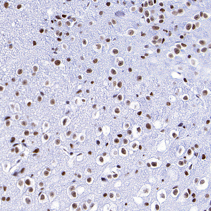 RBBP4 Rabbit Polyclonal Antibody