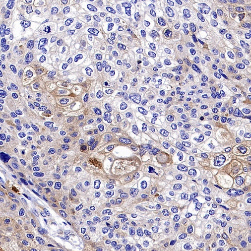 Progranulin Recombinant Rabbit mAb (S-2202-46)