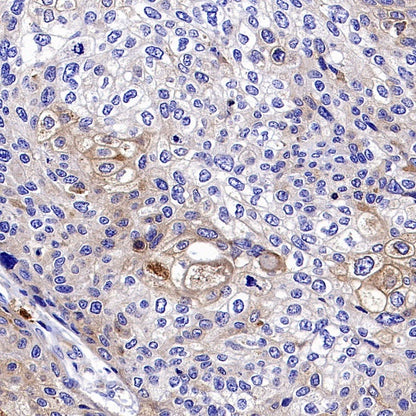 Progranulin Recombinant Rabbit mAb (S-2202-46)