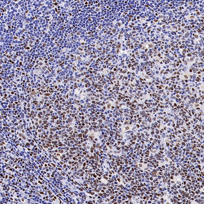 CREB (phospho S133) Recombinant Rabbit mAb (S-1100-102)