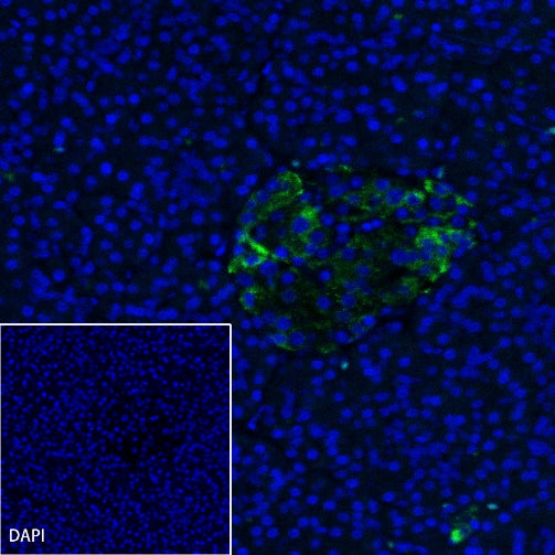 Somatostatin Receptor 2 Recombinant Rabbit mAb (SDT-2507-1)