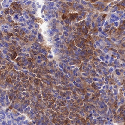 PI3 Kinase p85α Recombinant Rabbit mAb (S-328-24)