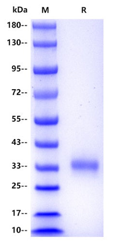 Human CHODL Protein, His tag