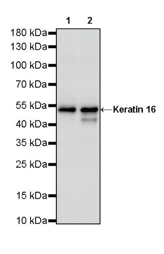 Keratin 16 Recombinant Rabbit mAb (S-R306)