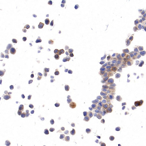Claudin 9 Recombinant Rabbit mAb (S-2849-16)