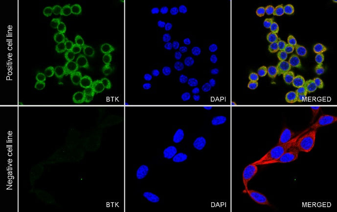 BTK Recombinant Rabbit mAb (SDT-2105-37)