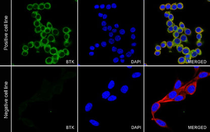 BTK Recombinant Rabbit mAb (SDT-2105-37)