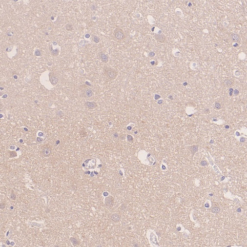 IRGQ Recombinant Rabbit mAb (S-2648-17)