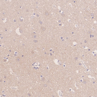 IRGQ Recombinant Rabbit mAb (S-2648-17)