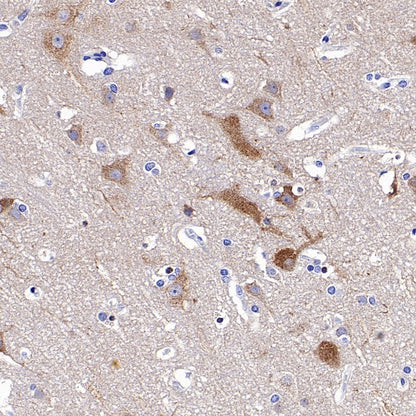 FUNDC1 Rabbit Polyclonal Antibody