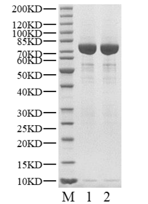 Biotinylated BTK Protein, Human