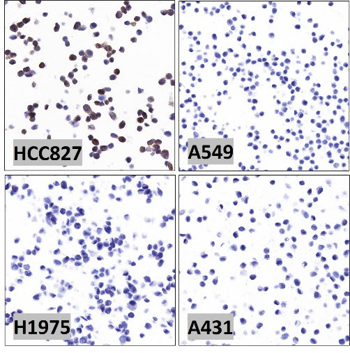 EGFR (delE746-A750) Recombinant Rabbit mAb (S-451-168)