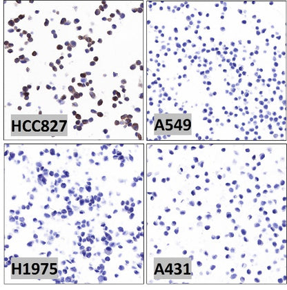 EGFR (delE746-A750) Recombinant Rabbit mAb (S-451-168)