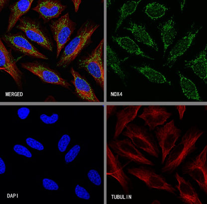 NOX4 Recombinant Rabbit mAb (S-2246-45)