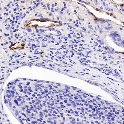 Von Willebrand Factor Recombinant Rabbit mAb (S-663-120)